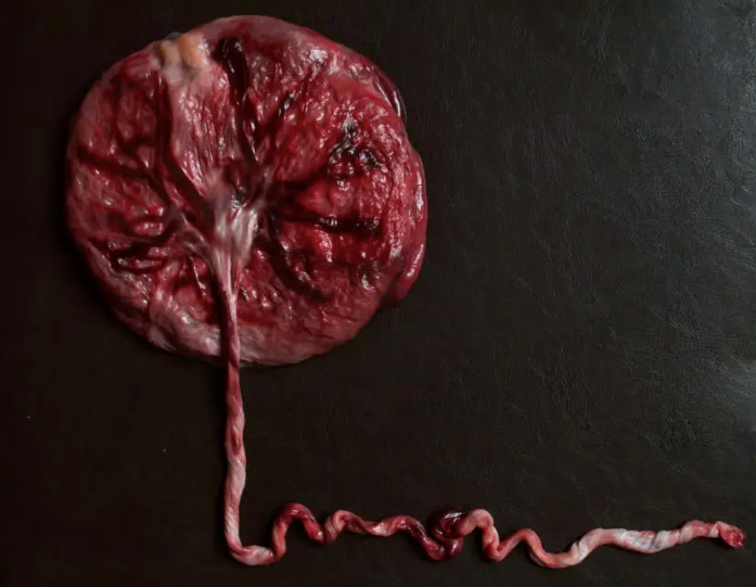 Beyond Birth: 4 Beautiful Ways to Honor Your Placenta